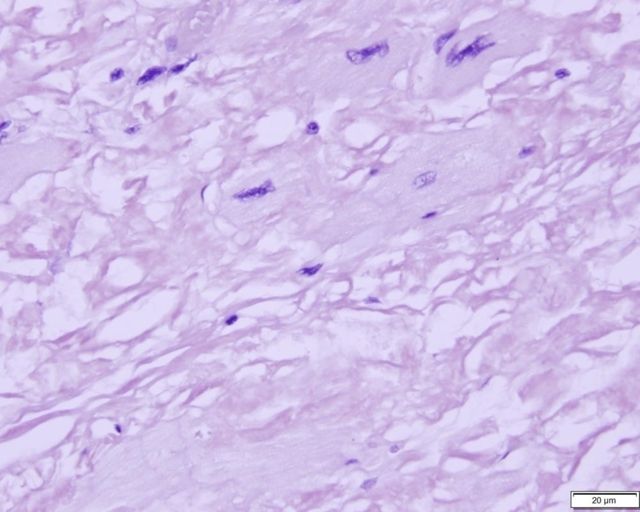Azer Scientific Control SLIDE Amyloid