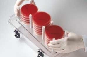 BD GasPak EZ Container Systems BD Diagnostics  Incubation Container Rack Large