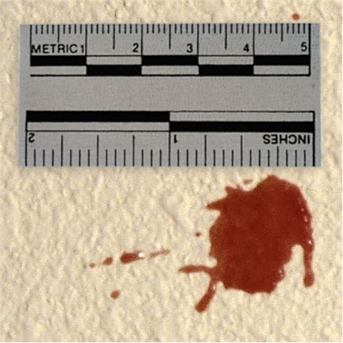 Forensics Source Adh White Scales Roll 150 - Forensics Source