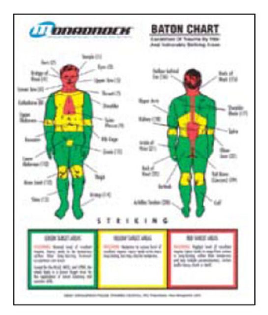 Monadnock Baton Trauma Zone Poster And Quick Reference Tool - 1000319 - Monadnock